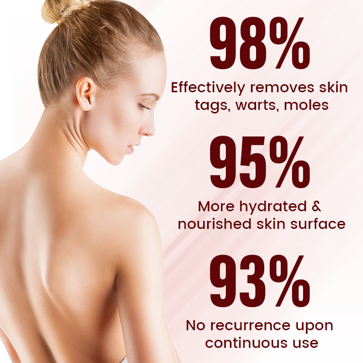 Timilk® Vionara Nano WartErase Patch(A)