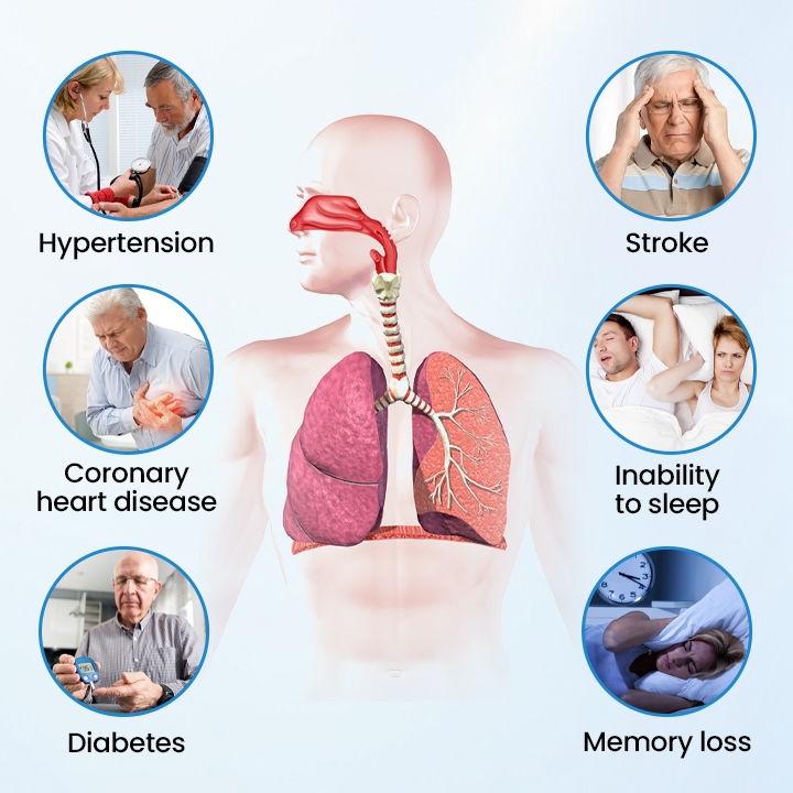 Timilk® SnoreLess Nasal Breather (A)