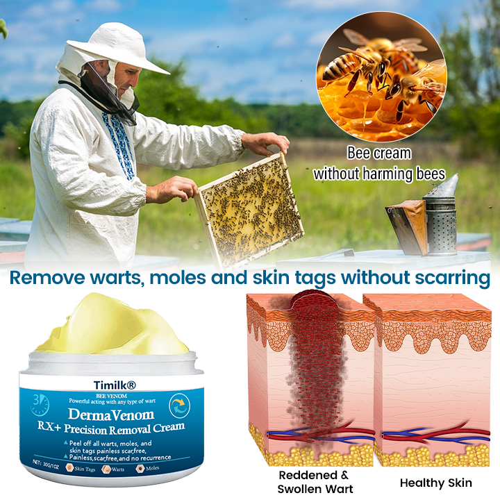 Timilk® DermaVenom RX+ Precision Removal Cream (A)