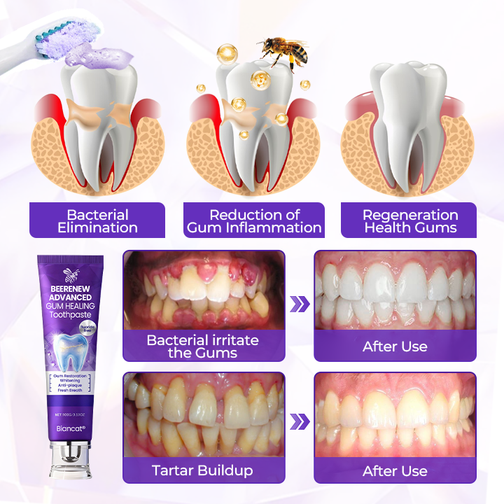 Biancat® BeeRenew Advanced Gum Healing Toothpaste 🔥