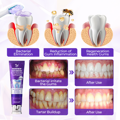 Biancat® BeeRenew Advanced Gum Healing Toothpaste 🔥
