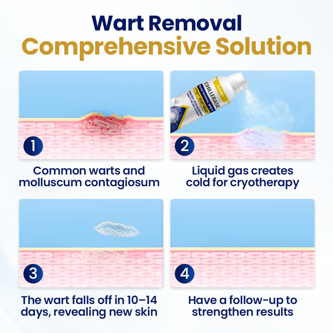 Timilk® ChillErase Bump Renewal Spray (A)