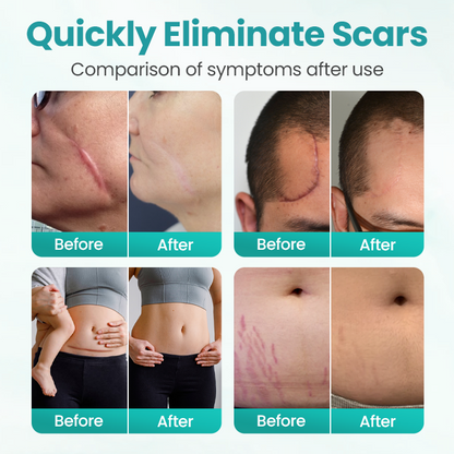 Timilk® EliteAloe ScarSolve Spray
