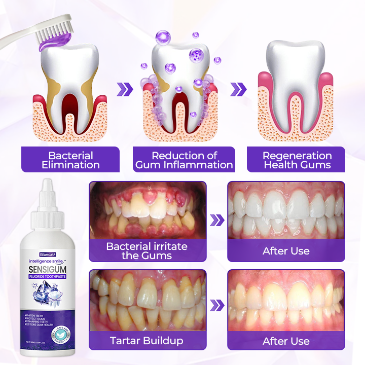 Biancat® SensiGum Fluoride Toothpaste✨