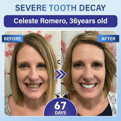 Your Smile🦷Ceoerty® Tooth & Gum Repair Fast-Dissolving Microneedle Patch✨ (𝟓-𝐢𝐧-𝟏 💎 𝐑𝐞𝐛𝐮𝐢𝐥𝐝 𝐄𝐧𝐚𝐦𝐞𝐥 & 𝐃𝐞𝐧𝐭𝐢𝐧 • 𝐒𝐭𝐫𝐞𝐧𝐠𝐭𝐡𝐞𝐧 𝐆𝐮𝐦𝐬 • 𝐄𝐫𝐚𝐝𝐢𝐜𝐚𝐭𝐞 𝐓𝐚𝐫𝐭𝐚𝐫 & 𝐎𝐝𝐨𝐫 • 𝐖𝐡𝐢𝐭𝐞𝐧𝐢𝐧𝐠 • 𝐒𝐭𝐨𝐩 𝐓𝐨𝐨𝐭𝐡 𝐒𝐞𝐧𝐬𝐢𝐭𝐢𝐯𝐢𝐭𝐲)✨