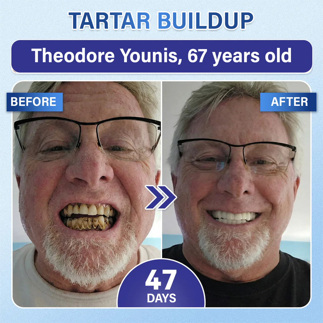 Your Smile🦷Ceoerty® Tooth & Gum Repair Fast-Dissolving Microneedle Patch✨ (𝟓-𝐢𝐧-𝟏 💎 𝐑𝐞𝐛𝐮𝐢𝐥𝐝 𝐄𝐧𝐚𝐦𝐞𝐥 & 𝐃𝐞𝐧𝐭𝐢𝐧 • 𝐒𝐭𝐫𝐞𝐧𝐠𝐭𝐡𝐞𝐧 𝐆𝐮𝐦𝐬 • 𝐄𝐫𝐚𝐝𝐢𝐜𝐚𝐭𝐞 𝐓𝐚𝐫𝐭𝐚𝐫 & 𝐎𝐝𝐨𝐫 • 𝐖𝐡𝐢𝐭𝐞𝐧𝐢𝐧𝐠 • 𝐒𝐭𝐨𝐩 𝐓𝐨𝐨𝐭𝐡 𝐒𝐞𝐧𝐬𝐢𝐭𝐢𝐯𝐢𝐭𝐲)✨
