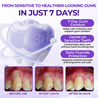 Biancat® SensiGum Fluoride Toothpaste✨