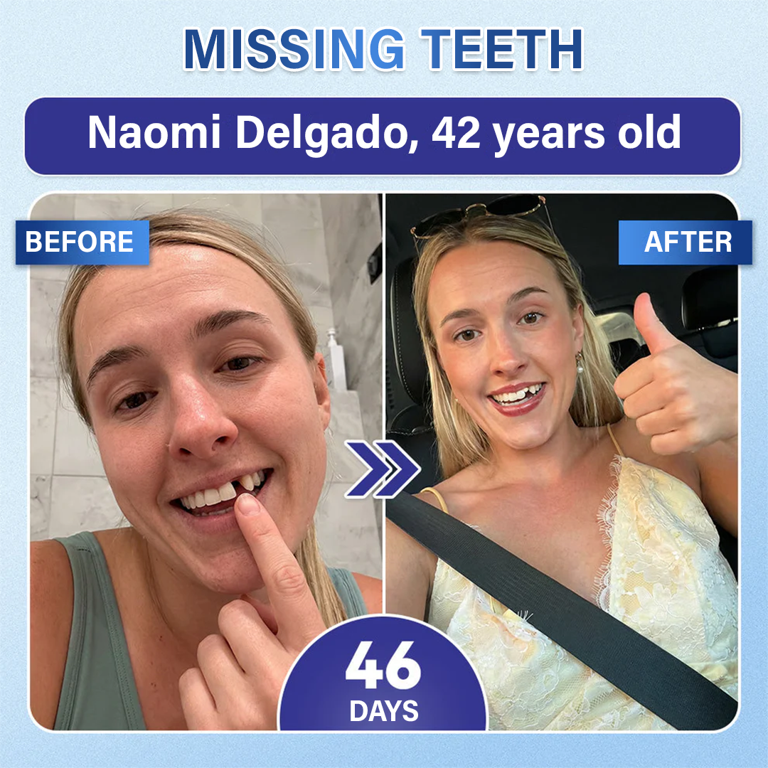 Your Smile🦷Ceoerty® Tooth & Gum Repair Fast-Dissolving Microneedle Patch✨ (𝟓-𝐢𝐧-𝟏 💎 𝐑𝐞𝐛𝐮𝐢𝐥𝐝 𝐄𝐧𝐚𝐦𝐞𝐥 & 𝐃𝐞𝐧𝐭𝐢𝐧 • 𝐒𝐭𝐫𝐞𝐧𝐠𝐭𝐡𝐞𝐧 𝐆𝐮𝐦𝐬 • 𝐄𝐫𝐚𝐝𝐢𝐜𝐚𝐭𝐞 𝐓𝐚𝐫𝐭𝐚𝐫 & 𝐎𝐝𝐨𝐫 • 𝐖𝐡𝐢𝐭𝐞𝐧𝐢𝐧𝐠 • 𝐒𝐭𝐨𝐩 𝐓𝐨𝐨𝐭𝐡 𝐒𝐞𝐧𝐬𝐢𝐭𝐢𝐯𝐢𝐭𝐲)✨