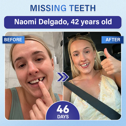 Your Smile🦷Ceoerty® Tooth & Gum Repair Fast-Dissolving Microneedle Patch✨ (𝟓-𝐢𝐧-𝟏 💎 𝐑𝐞𝐛𝐮𝐢𝐥𝐝 𝐄𝐧𝐚𝐦𝐞𝐥 & 𝐃𝐞𝐧𝐭𝐢𝐧 • 𝐒𝐭𝐫𝐞𝐧𝐠𝐭𝐡𝐞𝐧 𝐆𝐮𝐦𝐬 • 𝐄𝐫𝐚𝐝𝐢𝐜𝐚𝐭𝐞 𝐓𝐚𝐫𝐭𝐚𝐫 & 𝐎𝐝𝐨𝐫 • 𝐖𝐡𝐢𝐭𝐞𝐧𝐢𝐧𝐠 • 𝐒𝐭𝐨𝐩 𝐓𝐨𝐨𝐭𝐡 𝐒𝐞𝐧𝐬𝐢𝐭𝐢𝐯𝐢𝐭𝐲)✨