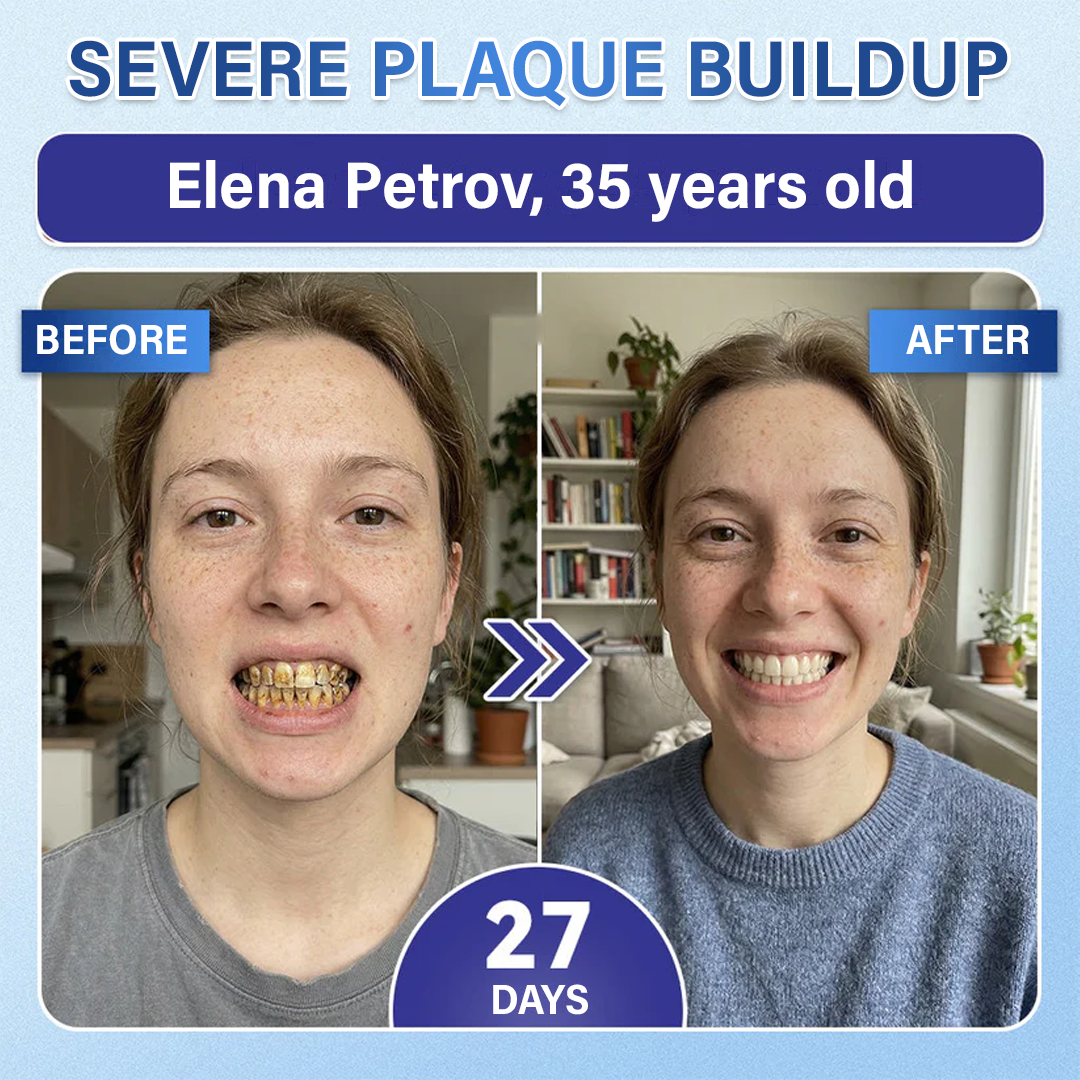 Your Smile🦷Ceoerty® Tooth & Gum Repair Fast-Dissolving Microneedle Patch✨ (𝟓-𝐢𝐧-𝟏 💎 𝐑𝐞𝐛𝐮𝐢𝐥𝐝 𝐄𝐧𝐚𝐦𝐞𝐥 & 𝐃𝐞𝐧𝐭𝐢𝐧 • 𝐒𝐭𝐫𝐞𝐧𝐠𝐭𝐡𝐞𝐧 𝐆𝐮𝐦𝐬 • 𝐄𝐫𝐚𝐝𝐢𝐜𝐚𝐭𝐞 𝐓𝐚𝐫𝐭𝐚𝐫 & 𝐎𝐝𝐨𝐫 • 𝐖𝐡𝐢𝐭𝐞𝐧𝐢𝐧𝐠 • 𝐒𝐭𝐨𝐩 𝐓𝐨𝐨𝐭𝐡 𝐒𝐞𝐧𝐬𝐢𝐭𝐢𝐯𝐢𝐭𝐲)✨