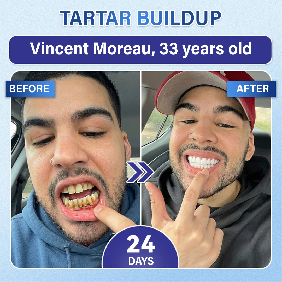Your Smile🦷Ceoerty® Tooth & Gum Repair Fast-Dissolving Microneedle Patch✨ (𝟓-𝐢𝐧-𝟏 💎 𝐑𝐞𝐛𝐮𝐢𝐥𝐝 𝐄𝐧𝐚𝐦𝐞𝐥 & 𝐃𝐞𝐧𝐭𝐢𝐧 • 𝐒𝐭𝐫𝐞𝐧𝐠𝐭𝐡𝐞𝐧 𝐆𝐮𝐦𝐬 • 𝐄𝐫𝐚𝐝𝐢𝐜𝐚𝐭𝐞 𝐓𝐚𝐫𝐭𝐚𝐫 & 𝐎𝐝𝐨𝐫 • 𝐖𝐡𝐢𝐭𝐞𝐧𝐢𝐧𝐠 • 𝐒𝐭𝐨𝐩 𝐓𝐨𝐨𝐭𝐡 𝐒𝐞𝐧𝐬𝐢𝐭𝐢𝐯𝐢𝐭𝐲)