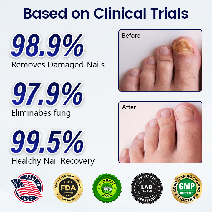 Timilk® Anti-Fungal Nail Repair Patch🔥(A)