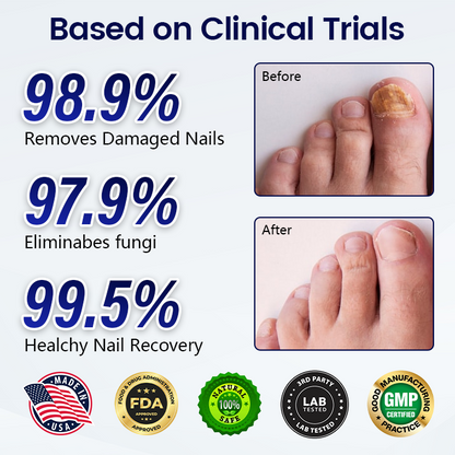 Timilk® Anti-Fungal Nail Repair Patch🔥(A)