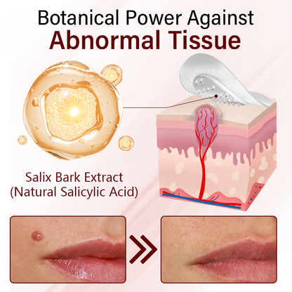 Timilk® Vionara Nano WartErase Patch（A)