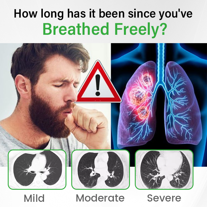 Timilk® Pulmovia Quercetin Lung Detox Inhaler ✨(A)