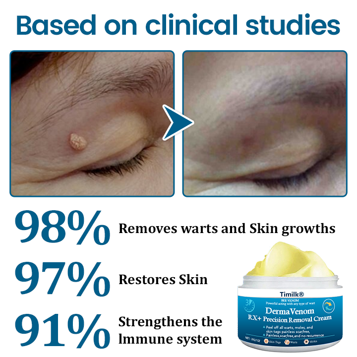 Timilk® DermaVenom RX+ Precision Removal Cream (A)