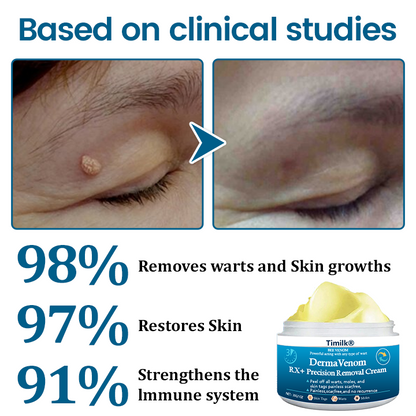 Timilk® DermaVenom RX+ Precision Removal Cream (A)