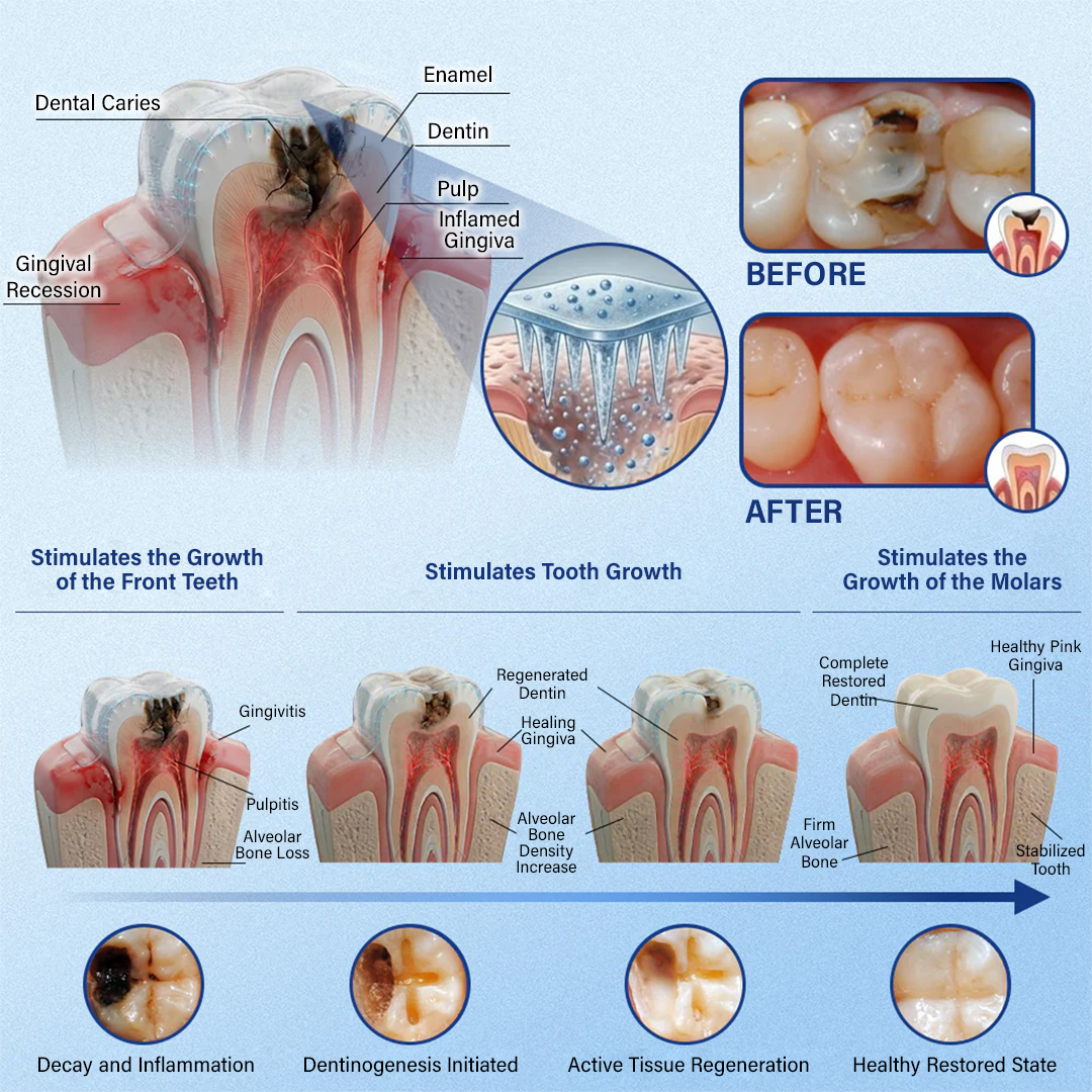 Your Smile🦷Ceoerty® Tooth & Gum Repair Fast-Dissolving Microneedle Patch✨ (𝟓-𝐢𝐧-𝟏 💎 𝐑𝐞𝐛𝐮𝐢𝐥𝐝 𝐄𝐧𝐚𝐦𝐞𝐥 & 𝐃𝐞𝐧𝐭𝐢𝐧 • 𝐒𝐭𝐫𝐞𝐧𝐠𝐭𝐡𝐞𝐧 𝐆𝐮𝐦𝐬 • 𝐄𝐫𝐚𝐝𝐢𝐜𝐚𝐭𝐞 𝐓𝐚𝐫𝐭𝐚𝐫 & 𝐎𝐝𝐨𝐫 • 𝐖𝐡𝐢𝐭𝐞𝐧𝐢𝐧𝐠 • 𝐒𝐭𝐨𝐩 𝐓𝐨𝐨𝐭𝐡 𝐒𝐞𝐧𝐬𝐢𝐭𝐢𝐯𝐢𝐭𝐲)