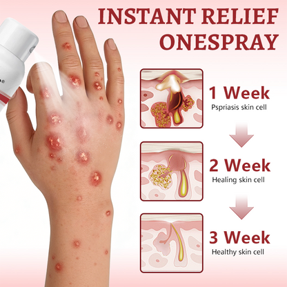 Healrize® Snail Mucin Healing Spray – Relief for Sensitive & Flare-Up Skin🔥