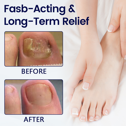 Timilk® Anti-Fungal Nail Repair Patch🔥(A)
