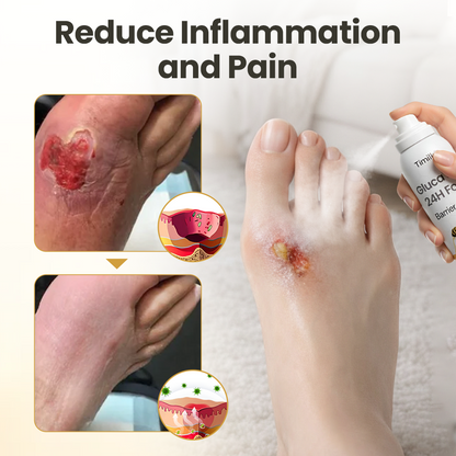 Timilk® GlucaVeil 24H Foot Barrier Spray✨ (A)