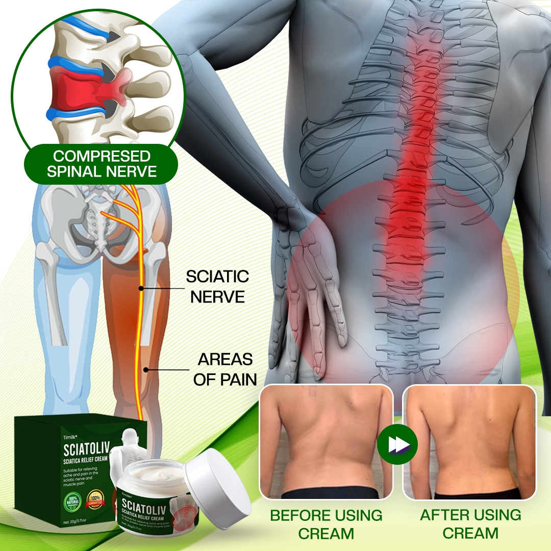 Timilk® Sciatoliv Sciatica Relief Cream (A)