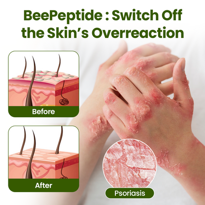 Timilk® BeePeptide RootSoft DualRelief Cream