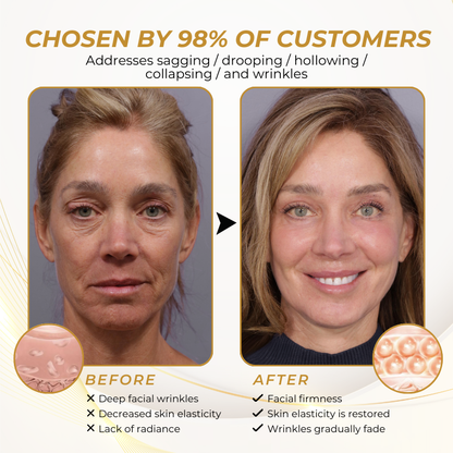 Timilk® FirmFlora Skin Lifting Cream