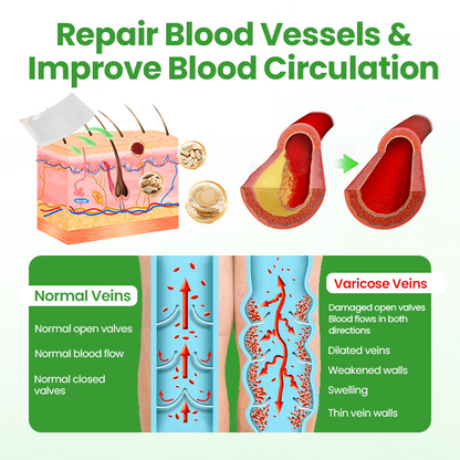 Healrize® VeinHeal Microneedle Patch✨