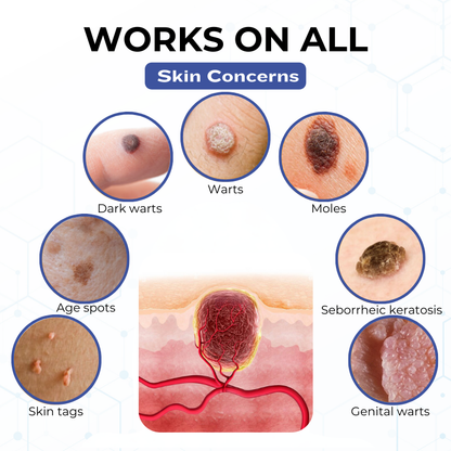 Timilk® VanishPro Skin Spot Removal Cream