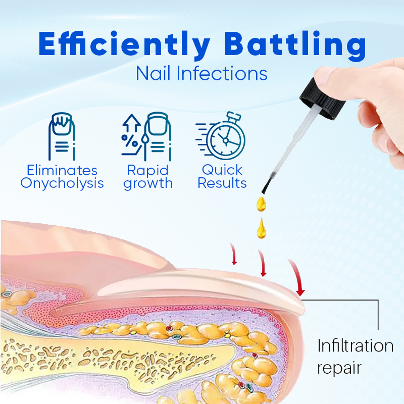 Biancat™ OnyxoGuard Nail Growth and Repair Serum👨‍⚕️Revive Your Nails, Complete Protection and Nourishment🔥(A)