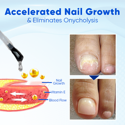 Biancat™ OnyxoGuard Nail Growth and Repair Serum👨‍⚕️Revive Your Nails, Complete Protection and Nourishment🔥(A)