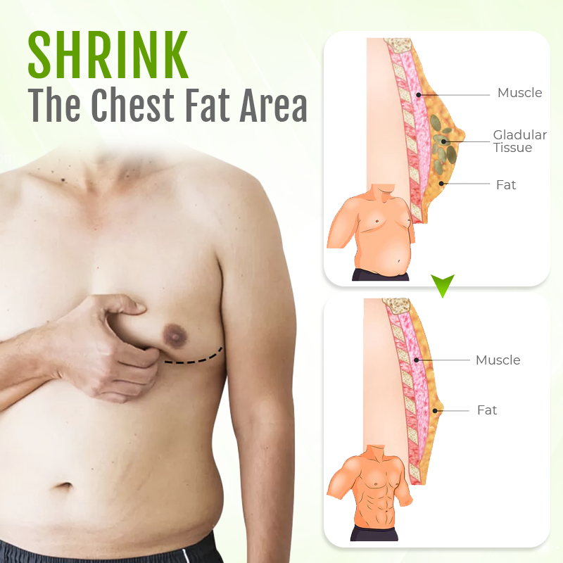 Biancat™ ChestFlex Turmeric Gynecomastia Patch -（A)