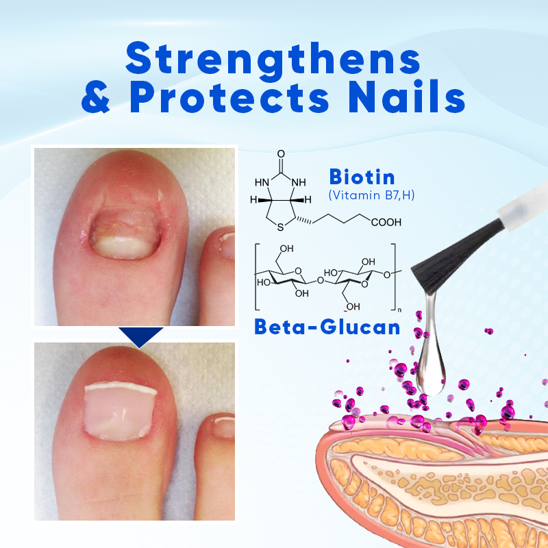 Biancat™ OnyxoGuard Nail Growth and Repair Serum👨‍⚕️Revive Your Nails, Complete Protection and Nourishment🔥(A)